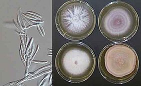 Ein Schimmelpilz der Gattung Fusarium unter dem Mikroskop (links) und in Laborkulturen. Fusarium ist einer der wichtigsten Erreger der Pilzkeratitis. (Bild: Nationales Referenzzentrum für Invasive Pilzinfektionen) Ein Schimmelpilz der Gattung Fusarium unter dem Mikroskop (links) und in Laborkulturen. Fusarium ist einer der wichtigsten Erreger der Pilzkeratitis. (Bild: Nationales Referenzzentrum für Invasive Pilzinfektionen)